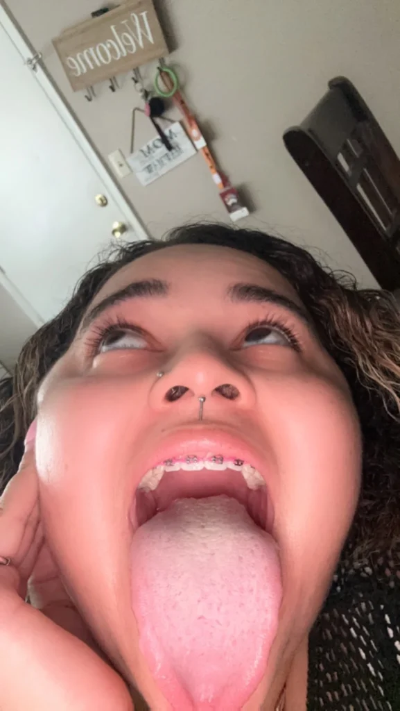 Carli b (@mscarlibabyy) Braces OnlyFans model sexy picture tongues out with braces.